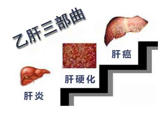 郑州哪里治疗肝病专业