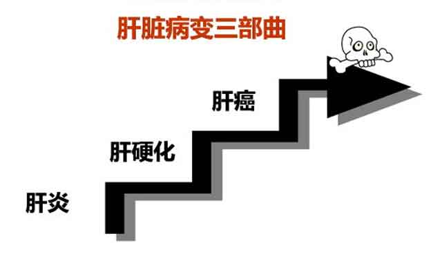 郑州看肝硬化上哪家医院?河南看肝硬化哪家医院好