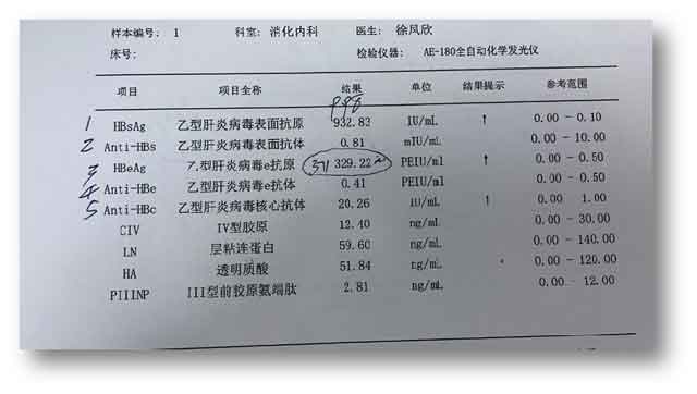 郑州去哪个医院治疗肝病?郑州专治肝病医院哪家好