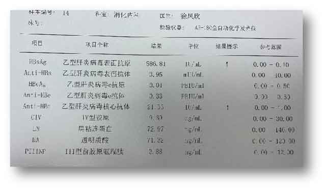 郑州去哪个医院治疗肝病?郑州专治肝病医院哪家好