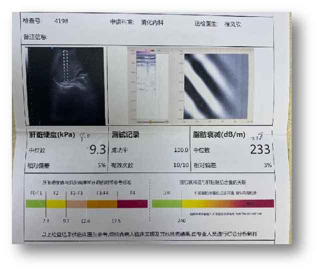 郑州去哪个医院治疗肝病?郑州专治肝病医院哪家好