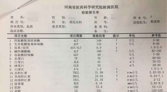 郑州肝硬化医院在线解答?郑州肝硬化哪家医院好