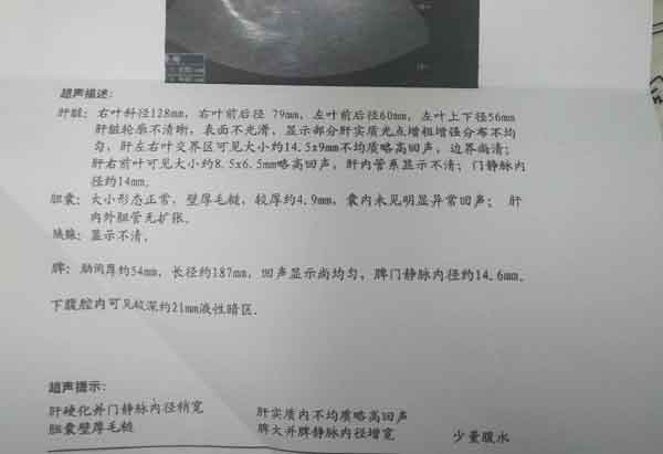 河南专业的肝硬化医院是哪家