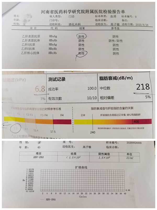 河南省治疗乙肝医院在哪里